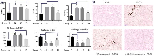 Figure 3. The serum (A) and tissue Prussian Blue staining (B) markers showing the existence of liver Fe deposition and dysfunction. Control group (A), PCOS group (B), NC-antagomir + PCOS group (C) and miR-761-antagomir + PCOS group (D). *p < .05; **p < .01.