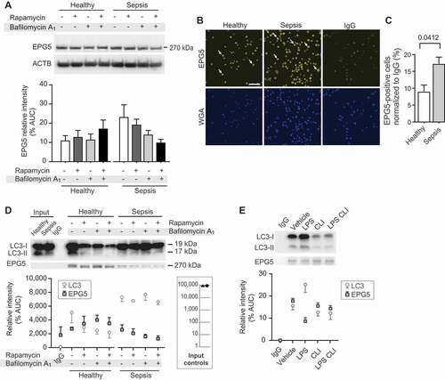 Figure 5. EPG5 protein expression is increased in septic platelets, while EPG5-LC3 interaction decreases during sepsis. (A) Platelets from healthy individuals and septic patients were isolated and treated with rapamycin and/or bafilomycin A1. EPG5 expression levels were detected by western blot. Position of EPG5 is marked. Corresponding ACTB is shown at the bottom and was used for normalization of data presented in bar graph below. This figure is representative of n = 6 independent experiments. (B) Platelets were fixed in suspension immediately after isolation. Immunofluorescence staining with an anti-EPG5 (yellow) antibody demonstrates robust expression of EPG5 protein in platelets from septic patients and healthy platelets (scale bars: 10 µm). Cells were co-stained using WGA (blue). White arrows highlight platelet cell bodies for orientation. This figure is representative of n = 3 independent experiments. (C) Micrographs were analyzed using CellProfiler. The bar graph displays the percent of positively stained cells for EPG5, normalized to IgG. (D) Endogenous LC3 precipitates endogenous EPG5 in a co-IP assay. Input samples as controls are indicated in inserted box. The open circles demonstrate the densitometric analysis of the co-IP experiment for LC3, the overlaid closed squares show the densitometric analysis of co-IP’d EPG5 for each experimental condition. This figure is representative of n = 7 independent experiments. (E) Endogenous LC3 precipitates endogenous EPG5 in a co-IP assay using MKs cultured under simulated septic conditions (LPS treatment) and treated with specific TLR4 inhibitor, CLI-095. This immunoblot is representative of n = 4 independent experiments. In the graph below the immunoblot, the open circles demonstrate the densitometric analysis of the co-IP experiment for LC3, while the overlaid closed squares show the densitometric analysis of co-IP’d EPG5.