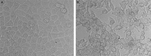 Figure 1.  Cytopathic effect in IBV-infected HeLa cells. Confluent HeLa monolayers in 100-ml cell culture flasks were inoculated with 1 ml allantoic fluid containing 5×103.4 median egg infectious doses of IBV 41. After 72, CPE was observed. 1a: Mock-infected HeLa cells showing normally growing cells and intact monolayer. 1b: IBV-infected HeLa cells showing CPE: cell rounding, congregating and detaching from the substrate.