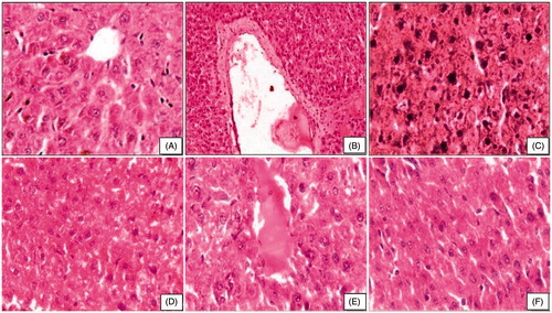Figure 1. Photomicrograph of liver after subchronic exposure to beryllium followed by combination therapy of moringa oleifera. (A) Control rats showing well-formed chord arrangement of hepatocytes and central vein (HE, 400×). (B and C) Beryllium-treated rats showing central camal with debris, loss of chord arrangement, nuclei of hepatocytes are irregular, and hyperchromatic (HE, 100×, 400×). (D) Therapy with MO 150 mg showing large vesicular nuclei and proliferation of camamiculi (HE, 400×). (E) Therapy with MO+Pip showing congested central camal (HE, 400×). (F) Therapy with MO+Cur showing histoarchitecture of liver (HE, 400×).