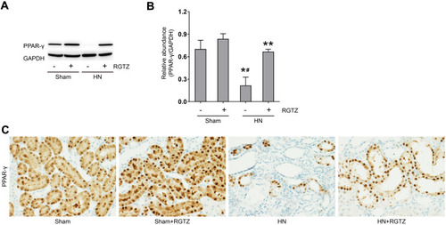 Figure 1 RGTZ induces PPAR-γ activation in the kidneys of HN rats. (A) A rat model of HN was established by daily oral administration of a mixture of adenine and potassium oxonate. In some rats, RGTZ was administrated. After 3 weeks, the kidneys were taken for immunoblot analysis for PPAR-γ or glyceraldehyde 3-phosphate dehydrogenase (GAPDH). (B) Expression levels of PPAR-γ were calculated by densitometry, and the ratio between PPAR-γ and GAPDH was determined. (C) Photomicrographs (original magnification, ×400) illustrate immunohistochemical PPAR-γ staining of kidney tissues. RGTZ, rosiglitazone. Data are represented as the mean ± SEM. *p < 0.05 versus sham group; #p < 0.05 versus sham + RGTZ group. **p< 0.05 versus HN group.