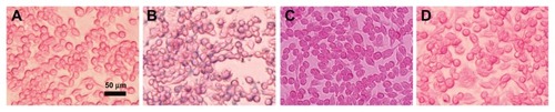 Figure 6 Prussian blue staining micrographs of macrophage cells (RAW264.7). (A) Control without contrast agent, and cells treated with (B) SPIONs, (C) ML, and (D) Bt-ML.Note: Blue stain density reflects the level of SPIONs accumulation within cells.Abbreviations: SPIONs, superparamagnetic iron oxide nanoparticles; ML, magnetoliposomes; Bt-ML, biotinylated magnetoliposomes.