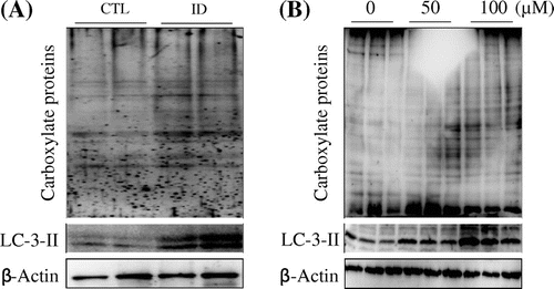Fig. 1. Effects of iron-deficiency on oxidation of proteins and autophagy.Notes: (A) Mouse heart tissues and per mice were homogenized with fourfold of homogenization buffer, after which Western blot analyses were performed to detect the carbonyl proteins using anti-DNP antibody and an autophagic marker, LC3-II antibody. (B) Western blots of 100 μM DFO-treated and DFO-untreated NIH 3T3 cells for 24 h lysates probed for DNP and LC3-II. β-Actin was used as internal control.