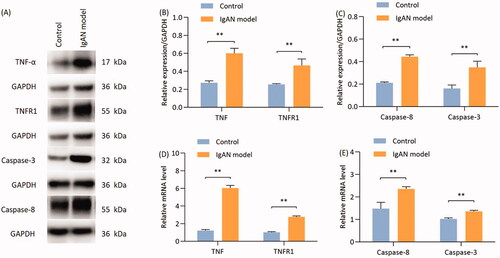 Figure 6. Proteins and mRNA expression of TNF-α, TNFR1, caspase-8 and caspase-3 are significantly reduced in IgAN mouse kidneys. (A) Western blotting results and (B) relative protein expression of TNF-α and TNFR1. (A) Western blotting results and (C) relative protein expression of caspase-8 and caspase-3. (D) Transcription levels of TNF-α and TNFR1 (n = 3). (E) Transcription levels of caspase-8 and caspase-3 (n = 3). Data are expressed as mean ± SD for groups of 20 mice. *p < 0.05, **p < 0.01 vs. control group. TNFR1, TNF receptor 1; IgAN, IgA nephropathy.
