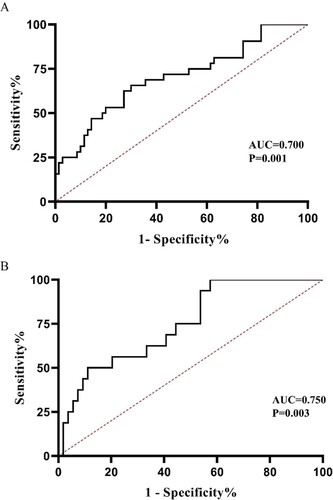Figure 2. Areas under the curve (AUC) of receiver operating characteristic (ROC) curves using miR-181a-2-3p for (A) differentiating patients with MDS from normal controls, and (B) distinguishing sAML from newly diagnosed MDS patients.