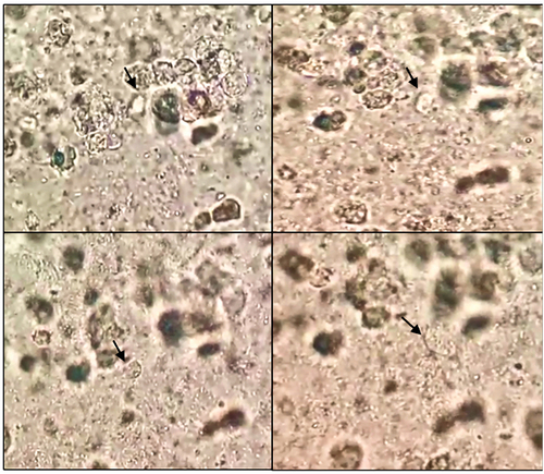Figure 4. Sequential microscopic examination of Lophomonas (black arrow) in the direct smear of bronchial aspirate.