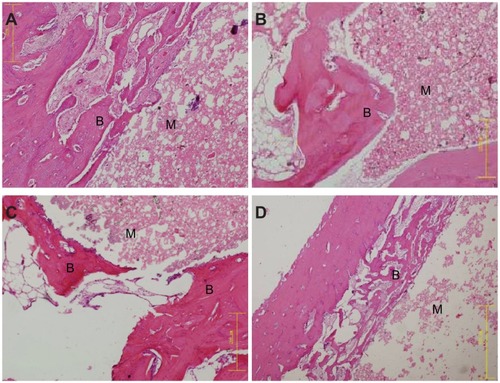Figure 11 Hematoxylin and eosin–stained sections (magnification, ×20) of wollastonite nanofiber–doped calcium phosphate cement with 10 wt% wollastonite nanofiber samples implanted into bone defects of rabbit femora for (A) 3, (B) 6, and (C) 12 weeks, and of (D) calcium phosphate cement implanted for 12 weeks.Notes: B represents new bone tissues; M represents implanted materials.