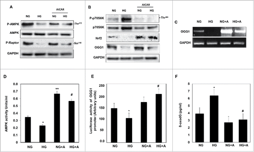 Figure 3. AICAR activates AMPK and decreases mTORC1 expression resulting in increased protein/mRNA expression and promoter activity of OGG1 and decreased 8-oxodG in HG-treated renal proximal tubular cells. High glucose significantly decreased AMPK phosphorylation and activates mTORC1 measured by decrease (A) in phosphorylation of raptor at Ser92 and (B) an increase in phosphorylation of p70S6k at Thr389 in MCT cells. (A) Cells treated with AICAR before exposure to HG show a significantly increased in activation of AMPK, which decreases mTORC1 expression. (B) Enhance AMPK activity and inhibition of mTORC1 by AICAR leads to upregulation of Nrf2 and OGG1 protein expression in cell exposed to HG. (C) RT-PCR of OGG1 was performed in RNA isolated from MCT cells grown in NG or HG and treated with AICAR. PCR products were analyzed on an ethidium bromide-stained gel. GAPDG was used a loading control. (D) AMPK activity was measured as phosphorylation levels of AMPK at Thr172 in HG or/and AICAR treated MCT cell lysates by AMPK ELISA kit. (E) A reporter plasmid containing the OGG1 promoter driving expression of the luciferase and a control Renilla reporter gene were co-transfected into the cells using LipofectAMINE Plus Reagent™. AICAR pretreatment reversed the inhibitory effect of HG on OGG1 promoter activity as well as significantly increased OGG1 activity in cells grown in NG. (F) DNA was extracted from treated and non-treated cells and digested with nuclease P1. The detection of dG and 8-oxodG was performed using 8-oxodG kits. Authentic standards of 8-oxodG were analyzed simultaneously. Experiment represent means±SE (n = 6). Significant difference from cells grown in normal glucose is indicated by *P < 0.01, cells grown in NG and treated with AICAR by **P < 0.01 and cells exposed to HG and treated with AICAR compared to cells grown in HG by #P < 0.01.