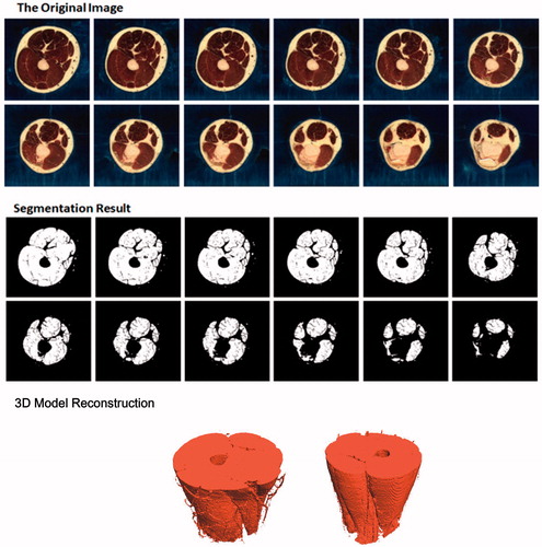 Figure 8. Vastus image segmentation and 3D construction of American male virtual human.