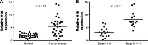 Figure 1 Comparison of lncRNA H19 expression level in breast cancers with different TNM stage.