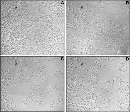 Figure 6 The cytomorphological study of AgNPs treated A549 cells (A) control, (B) IC25 (C) IC50, (D) IC75 at 20× magnification.