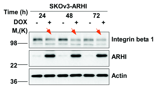 Figure 2. ARHI can inhibit cell migration through several mechanisms. A proposed model of ARHI action in a scheme.