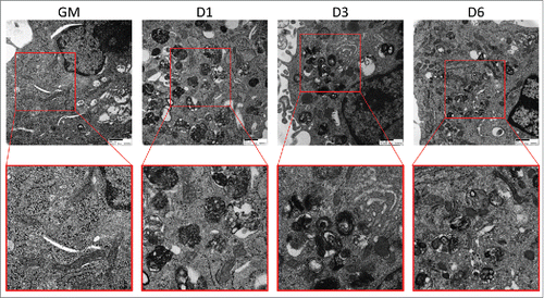 Figure 6. Electron micrographs of differentiating C2C12s treated with BAF. Transmission electron microscopy was performed on differentiating C2C12s treated with 100 nM BAF to examine alterations in mitochondrial populations. Insets are presented at higher magnification below each original image. Scale bars: 500 nm. GM, growth medium.