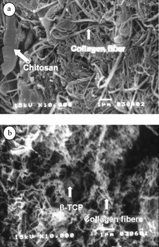 Figure 4 SEM micrograph of the chitosan-coated collagen/β-TCP microsphere: (a) surface (magnification: × 10000), and (b) inner section (magnification: × 10000). The microsphere contains 35% w collagen and 65% w β-TCP microsphere.