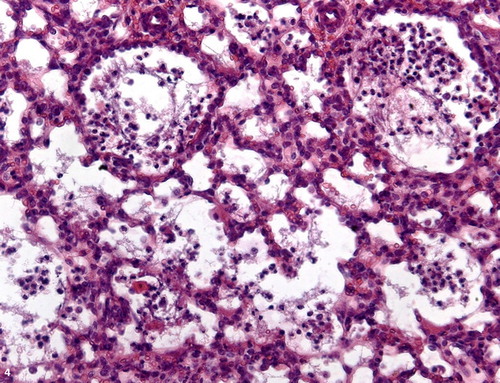 Figure 4. Pulmonary inflammation, lung lobe, ovine. Alveolar fibrin content and moderate amount of inflammatory cells dispersed within the parenchyma. H&E stain; bar = 100 μm.