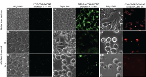 Figure 11 Targeted destruction of cancer cells by single-walled carbon nanotubes (SWCNTs) photothermal effect. Confocal images of cancer cells (MCF7) treated with fluorescein isothiocyanate (FITC)-polyethylene glycol (PEG)-SWCNTs (1), FITC-folic acid (FA)-PEG-SWCNTs (2), and DOX-FA-PEG-SWCNTs (3). Before laser treatment (A), confocal image after 3 minutes’ laser treatment and viewed after 12 hours (B), confocal image after 3 minutes’ laser treatment and viewed after 24 hours (C).