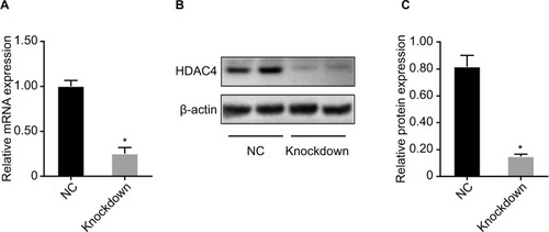 Figure 6 Transfection efficiency after HDAC4 knockdown.