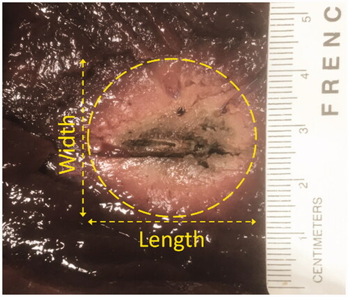Figure 4. Example image showing the cross-section of necrosis after 12 min of ex vivo bovine liver ablation.