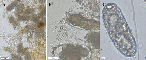 Figure 2. Effect of C. rosea culture filtrate on M. incognita egghatching. (A) Unhatched infected eggs. (B) Infected eggs covered with chlamydospores of C. rosea TNAU CR 01. (C) Bulged eggs.