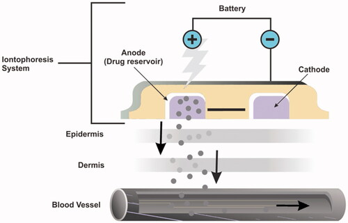 Figure 4. Assembly of iontophoresis demonstrating the mechanism of delivery anti-cancer drugs through skin.