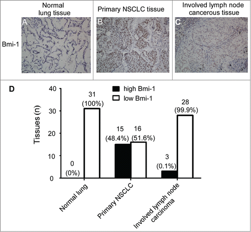 Figure 1. Enhanced expression of Bmi-1 in primary NSCLC tissues compared with the matched lymph node cancerous tissues. (A–C) Bmi-1 shows no or weak staining in the adjacent non-cancerous tissue (A), Strong Bmi-1 staining is detected in the primary NSCLC tissue (B). The matched lymph node cancerous tissues show lower Bmi-1 expression than that of NSCLC tissue (200×) (C). (D)Bmi-1 expression in involved lymph node cancerous tissues, primary NSCLC tissues and the corresponding normal lung tissues.