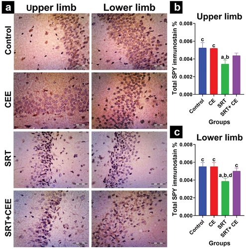 Figure 11. Impact of sertraline (SRT) and Cyperus esculentus extract (CEE) treatment on synaptogenesis in rat’s brain dentate gyrus. (a) Representative micrographs of SYP immunostained dentate gyrus upper limb and lower limb (X400). (b) Mean expressional levels of SYP in immunostained sections. Bars (mean ± SD) labeled with different letters indicate significant differences: asignificant variation with the control group, bwith the CEE group, cwith the SRT group, and dwith the SRT+CEE group.