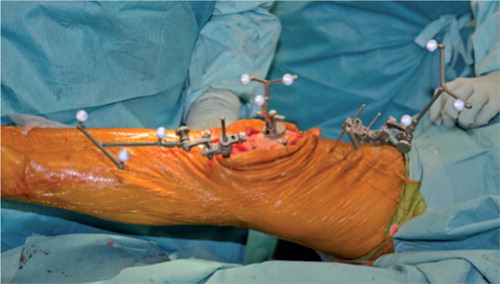 Figure 1. Intraoperative setup.