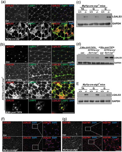 Figure 5. Damaged lysosomes are an early feature of VCP inactivation in muscle degeneration. (a) Co-immunofluorescence for LAMP2 (green) and LGALS3 (red), in 6-week-old control or Myl1p-cre-vcp-/- mice. (b) Co-immunofluorescence for LAMP2 (green) and LGALS3 (red) in control or ACTA1p-cre/Esr1-vcp-/- mice after 2 and 4 wk post tamoxifen injection for 5 d. (c) Immunoblot of lysates from TA, quadriceps or gastrocnemius muscle of 6-week-old control (+/+) or Myl1p-cre-vcp-/- (-/-) mice using antibodies to LGALS3 or GAPDH. (d) Immunoblot of lysates from TA of age-matched control or ACTA1p-cre/Esr1-vcp-/- mice after 2 and 4 wk post tamoxifen injection for 5 d using antibodies to LGALS3, or GAPDH. (e) Immunoblot of lysates from tibialis anterior, quadriceps or gastrocnemius muscle of 9-week-old control or Myl1p-cre-atg5-/- mice using antibodies to LGALS3 or GAPDH. f-g) Immunofluorescence for LGALS3 or SQSTM1 in control or 9-week-old Myl1p-cre-atg5-/- mouse muscle. DAPI (blue) stains nuclei. Scale: 100 μm.