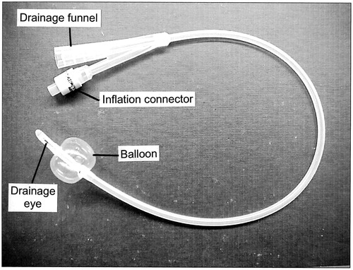Figure 4. A typical Foley catheter. This catheter is size 16 Fr. Its overall length is ∼400 mm and the volume of the fully-inflated balloon is ∼10 ml. The catheter has two channels. When the catheter has been inserted, the retaining balloon is inflated with sterile water from a syringe via the inflation connector and one of the channels. The inflation connector incorporates a valve to prevent the sterile water from escaping when the syringe is detached. The other channel allows the free flow of urine from the drainage eye to the drainage funnel. To remove the catheter, the retaining balloon is first deflated by withdrawing the water from it with a syringe, which opens the valve in the inflation connector when it is attached.