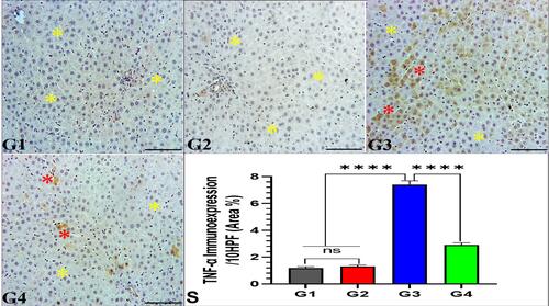 Figure 3 Effect of garlic extract on trastuzumab-induced TNF-α changes in the liver tissues. Liver tissues of G1 and G2 show normal hepatic architecture of hepatocytes without TNF-α immunoexpression (IE) at the yellow stars, while the liver tissues of G3 reveal focal areas of marked TNF-α IE (red stars) in-between normal hepatocytes without TNF-α IE (yellow stars). In contrast, G4 exhibits normal hepatic architecture without TNF-α IE (yellow stars) and focal areas of minimal TNF-α IE (red stars). TNF-α immunostaining, 200x, bar =100 µm. (S) Quantitative analysis of TNF-α IE area %/10 HPF. nsNo significance between G1 vs G2, ****Significance difference G1, G2 vs G3, and G3 vs G4 (p<0.001).