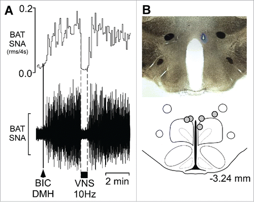 Figure 2. Vagal nerve stimulation (VNS) inhibits the increase in BAT SNA evoked by disinhibition of neurons in the dorsomedial hypothalamus (DMH) (A) Representative example demonstrating that VNS (10 Hz, 1 ms pulses, between the dotted lines) inhibits the increase in BAT SNA evoked by nanoinjection (black arrowhead) of bicuculline (BIC) in the DMH. Scale bar for BAT SNA is 50 µV. (B) A photomicrograph of a representative nanoinjection site (blue beads) and schematic representation of the BIC nanoinjection sites (filled circles) plotted on an atlas drawing, adapted from,Citation27 approximately 3.24 mm caudal to bregma that includes the DMH.