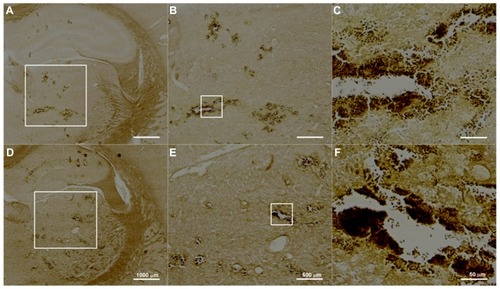 Figure 8 Examples of histological observations of TUNEL-stained sections treated with UCA doses of (A–C) 300 μL/kg and (D–F) 450 μL/kg sonicated at 2.86 W.Note: Many cells appear to be undergoing apoptosis in the sonicated brains.Abbreviation: UCA, ultrasound contrast agent.