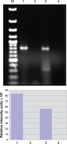 Figure 3 Spastin mRNA is bound to heterogeneous nuclear ribonucleoprotein (hnRNP) A1 in neuronal cells. Upper panel: agarose gel. Compared to the neuronal lysate without immunoprecipitation or input (lane 3), there is an enriched spastin mRNA signal following immunoprecipitation with anti-hnRNP A1 mouse monoclonal antibodies (lane 1). In contrast, spastin mRNA was not isolated following immunoprecipitation with a nonspecific control antibody – mouse IgG (lane 2). Lane 4 used spastin primers without lysate (control for DNA contamination). Lower panel: the image was analyzed using ImageQuant software, which provided relative fluorescent intensity of the bands.
