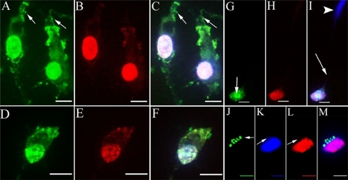 Figure 5 Death of different cochlear cell populations was induced by HPNP internalization. A–F) Internalization of HPNPs by the cochlear hair cell. Cytoplasmic vesicles and condensed homogenous nuclear distribution of HPNPs appeared in the outer hair cell incubated with 3.87 × 10−7 mol/L HPNPs (A–C) and inner hair cell incubated with 5 × 10−6 mol/L HPNPs (D–F). Vesicles were observed in the hair bundles (arrows in A and C). Figures B and E showed the permeation of propidium iodide. G–I) Spiral ganglion cell death was induced by HPNP internalization at a concentration of 9.7 × 10−8 mol/L (Arrow in G shows HPNPs in the neural soma of spiral ganglion cell). H) Shows the permeation of propidium iodide. I) shows the merged images of G and H (Arrow: nerve fiber. Arrow head: nuclei of Schwann cell). J–M) The nucleus was compressed by HPNP vesicles, and propidium iodide permeated the nucleus when the cells were exposed to 3.87 × 10−7 mol/L HPNPs (arrows). M is the merged image.Notes: Green: FITC-conjugated HPNPs. Red: propidium iodide permeation. Blue: nuclear staining by DAPI. Scale bars: A–C = 5 μm, D–F = 7.1 μm, G–M = 5 μm.Abbreviation: HPNPs, hyperbranched polylysine nanoparticles.