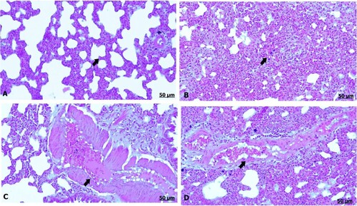 Figure 4. (A–D) Light photomicrograph of sections from maternal lung of control (A) and GAE received group (B–D) stained with H & E.: light photomicrograph of (A) shows normal parenchymatous tissues of the lung. Photomicrograph of (B) shows prominent thickening of the interalveolar septa. Photomicrograph of (C, D) shows severe thickening and congestion of the blood vessels.