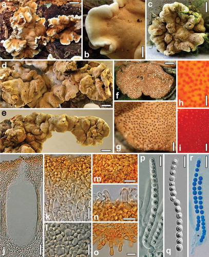 Fig. 2 Teleomorph of Hypocrea britdaniae. a, b. Fresh stromata. c–g. Dry stromata. h. Surface of rehydrated stroma. i. Surface of rehydrated stroma in 3% KOH. j. Perithecium in section. k. Cortex and subcortical tissue in section. l. Subperithecial tissue in section. m. Cortex in face view. n. Hairs on the stroma surface. o. Hairs at the stroma base. p–r. Asci (r. in cottonblue/lactic acid). a, b. Hampshire 28 Aug 2008 (images by Stuart Skeates). c–e, g–q. K(M) 89878. f, r. WU 31610. Bars: a = 15 mm; b, d = 2 mm; c, e = 3 mm; f = 0.6 mm; g = 0.3 mm; h, i = 0.15 mm; j = 30 μm; k, m, n, r = 10 μm; l, o = 15 μm; p, q = 7 μm.