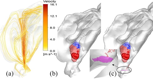 Figure 8. (a) Streamlines depicting the momentum-jet from the Flonase spray droplet injection at 10 ms. Location of the Flonase spray droplet deposition using (b) quasi two-way coupled approach and (c) one-way coupled approach. One-way coupled droplets in (c) that fall back on the spray nozzle tip are approximately 30 µm and smaller, representing approximately 13.5% of the injected droplet mass.