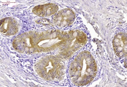 Figure 6.  The epithelial cells displayed cytokeratin immunoreactivity (cytokeratin immunostaining). Bar = 50 μm.
