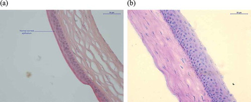 Figure 4. Representative image of a healthy cornea (a, normal), and a cornea presenting a hyperplastic appearance (b). Arrow indicates a normal epithelium in healthy mice compared to a hyperplastic squamous epithelium found in some DED mice