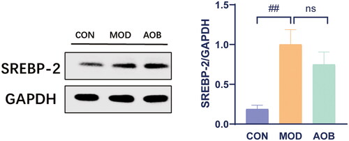 Figure 9. The expression of SREBP-2 in liver after AOB treatment for 8 weeks. The densitometric values of bands were quantitatively analyzed by Image J Densitometric values normalized to those in the model group and are presented as relative intensity. Data show mean ± SEM values of 6 independent samples. # Represents comparison with the control group, ## represents p < 0.01.
