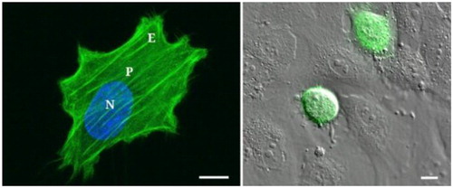 Figure 1. T24 cancer cell on a 28 kPa gel (measurement locations are N, P and E) and on HUVEC monolayer. Scale bar = 10µm. (Abidine et al. Citation2018).