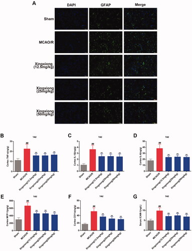 Figure 5. Xingxiong injection inhibits inflammatory response in rat cortex with MCAO/R. (A) Immunofluorescence for GFAP (14 days postreperfusion) in the cortex. Scale bar: 50 μm. Effect of Xingxiong injection treatment on cortex TNF-α (B), IL-1β (C), IL-6 (D), MCP-1 (E), CD11a (F) and ICAM-1 (G) in rats with MCAO/R. Data are expressed as the mean ± SD and were analysed by ANOVA. ##p < 0.01 vs. sham group; **p < 0.01 vs. MCAO/R group.