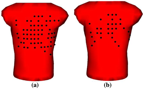 Figure 2. (a) 64-lead-set-I and (b) 32-lead-set-I.