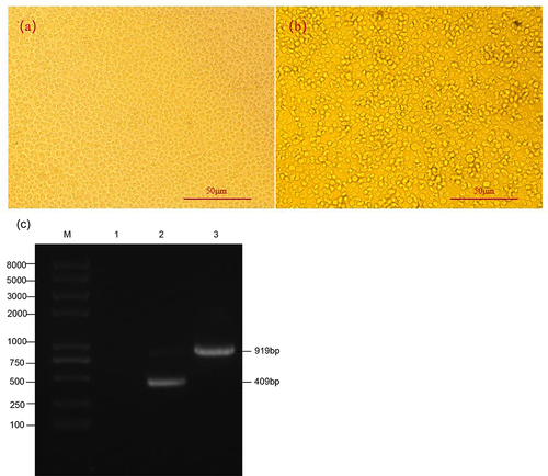 Figure 2 Construction of recombinant virus. (a) Normal cells; (b) Co-transfected cells; (c) M: DNA Marker; 1: PCR with reBmBac-Luc genome as template; 2: PCR with reBmBac-H11-D4 genome as template; 3: PCR with reBmBac-Fe-H11-D4 genome as template.