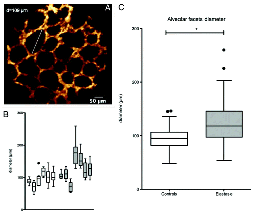 Figure 3. The subpleural alveolar facets could be observed with fiberd confocal fluorescence microscopy (FCFM) after a few minutes of examination. (A) The ten maximal diameters were selected for the quantitative analysis. (B) The 10 measures per animal are displayed as median ± interquartile range. Inter-individual variability, assessed by the inter-quartile range of the medians was [84–106] µm in the control group, and [104–152] µm in the elastase group. (C) The alveolar facets diameters were significantly higher in the elastase-treated animals (median = 118.5µm [IQR (97.2 - 145.9)]) than in controls (median = 95.1µm [IQR (81.6 - 106.8)]) (p < 0.0001, Mann-Whitney test).