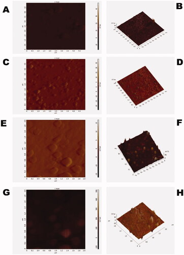 Figure 2. (A) 2-dimentional AFM batch of polymeric gemcitabine-loaded CS-NPs, (B) 3-dimentional AFM of polymeric gemcitabine-loaded CS-NPs, (C) 2-dimentional AFM batch of polymeric gemcitabine-loaded PSar-NPs, (D) 3-dimentional AFM of polymeric gemcitabine-loaded PSar-NPs, (E) 2-dimentional AFM batch of polymeric gemcitabine-loaded PLL-PSar-NPs, (F) 3-dimentional AFM of polymeric gemcitabine-loaded PLL-PSar-NPs, (G) 2-dimentional AFM batch of polymeric gemcitabine-loaded CS-PSar-NPs, and (H) 3-dimentional AFM of polymeric gemcitabine-loaded CS-PSar-NPs.