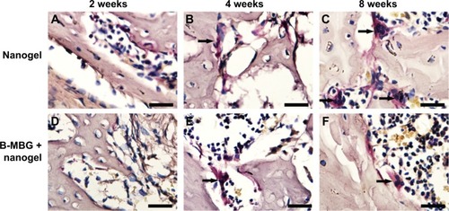 Figure 6 TRAP staining of PIB nanogels alone (A–C) and B-MBG/nanogels (D–F) at 2, 4, and 8 weeks post-implantation (bar =100 μm).Notes: Arrow depicts TRAP staining in multinucleated cells bordering either the scaffold surface or peripheral bone surface.Abbreviations: TRAP, tartrate-resistant acid phosphatase; PIB, p(N-isopropylacrylamide-co-butyl methylacrylate); B-MBG, boron-containing mesoporous bioactive glass.