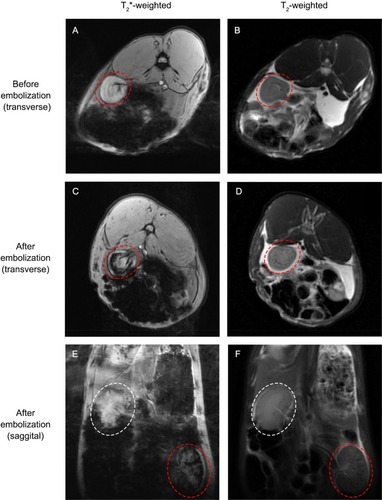 Figure 14 MR images of embolized kidney with T2*- and T2-weighted sequences before and after embolization.Notes: The rabbit’s left embolized kidney was denoted by red elliptical rings while the right untreated kidney was denoted by white elliptical rings.Abbreviation: MR, magnetic resonance.
