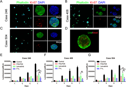 Figure 6 Proliferation ability and drug response in the XDOTS models. (A–C) Magenta indicates the expression of Ki-67 in proliferating cells. The cells were stained with DAPI (blue) and phalloidin (green) to detect nuclei and actin. Images were captured using a confocal laser-scanning microscope (Nikon A1R). The scale bar is 50 µm. (D) Live cells were stained with calcein-AM (green), and dead cells were stained with propidium iodide (red). Images were captured using the Olympus Fluoview FV1000 (Olympus). Scale bar is 100 µm. (E–G) Inhibitory effects of lenvatinib (10 µM) and FOLFOX (5-FU, 10 µg/mL; oxaliplatin, 1 µg/mL) on XDOTS models after 1 week of drug administration. The data are expressed as the mean ± SD (n=3; b P < 0.01, compared to the control group; ##P < 0.01, compared with monotherapy).