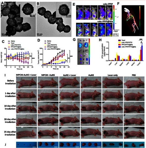 Figure 5 (A, B) TEM images of AuNPs, and macrophage cell membrane-camouﬂaged AuNPs, respectively. (C) Body weight and (D) tumor volume data were recorded in the course of 3-week treatment. (E) IVIS images of mice injected with cskc-PPiP and cskc-PPiP@ Ma loaded with near-infrared probe. (F) 48 hours post-treatment, 3D reconstruction of ﬂuorescence signal were conducted in cskc-PPiP@Ma-treated mouse. (G) Major organs like heart (H), liver (Li), spleen (S), lung (Lu), kidney (K), and tumor (T) excised from the cskc-PPiP and cskc-PPiP@ Ma injected mouse. (H) Quantiﬁcation of PTX concentration in organs and tumor tissue excised from mice treated with Taxol, cskc-PPiP/PTX, PPC8/PTX@Ma, and cskc-PPiP/PTX@Ma (n=4). (I) Photographs of the tumor region were taken after 5 minutes of 1 W/cm2 NIR irradiation. (J) Photographs of relevant tumors in accordance with each group in (I). All scale bars are 2 cm. Reprinted with permission from Xuan M, Shao J, Dai L, Li J, He Q. Macrophage cell membrane camouflged Au nanoshells for in vivo prolonged circulation life and enhanced cancer photothermal therapy. ACS Appl Mater Interfaces. 2016;8(15):9610–9618. doi:10.1021/acsami.6b00853. doi:10.1021/nn503779d. Copyright 2016 American Chemical Society.Citation67 Reproduced with permission from Refs.Citation67 Reprinted with permission from Zhang Y, Cai K, Li C, et al. Macrophage-membrane-coated nanoparticles for tumor-targeted chemotherapy. Nano Lett. 2018;18(3):1908–1915. doi:10.1021/acs.nanolett.7b05263. Copyright 2018 American Chemical Society.Citation68Notes: Fig 5 parts A, B, I, J is taken from reference 67, parts C-H is taken from reference 68.Abbreviations: MPCM, macrophage cell membrane; AuNSs, gold nanoshells; PPiP, cationic 2aminoethyldiisopropyl group; PPC8, pH-insensitive polymer with neutral octyl group side chains.